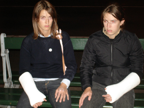 Broken arms